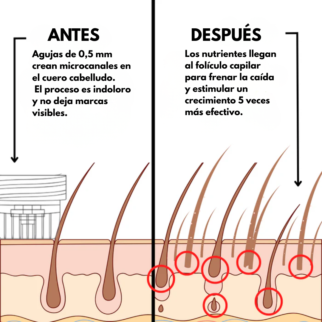 Sistema de Regeneración Capilar