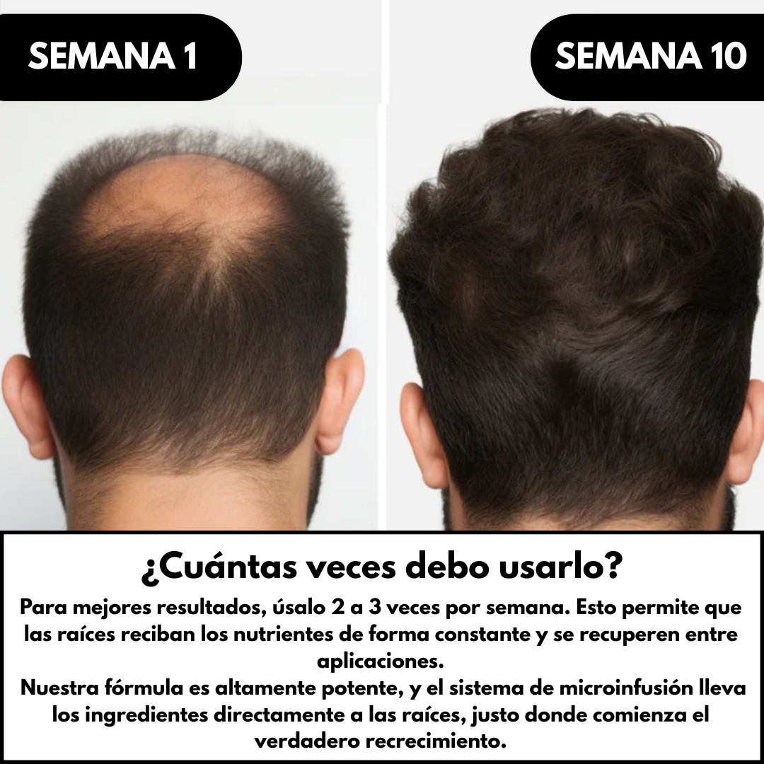 Sistema de Regeneración Capilar