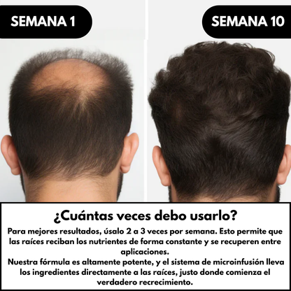 Sistema de Regeneración Capilar