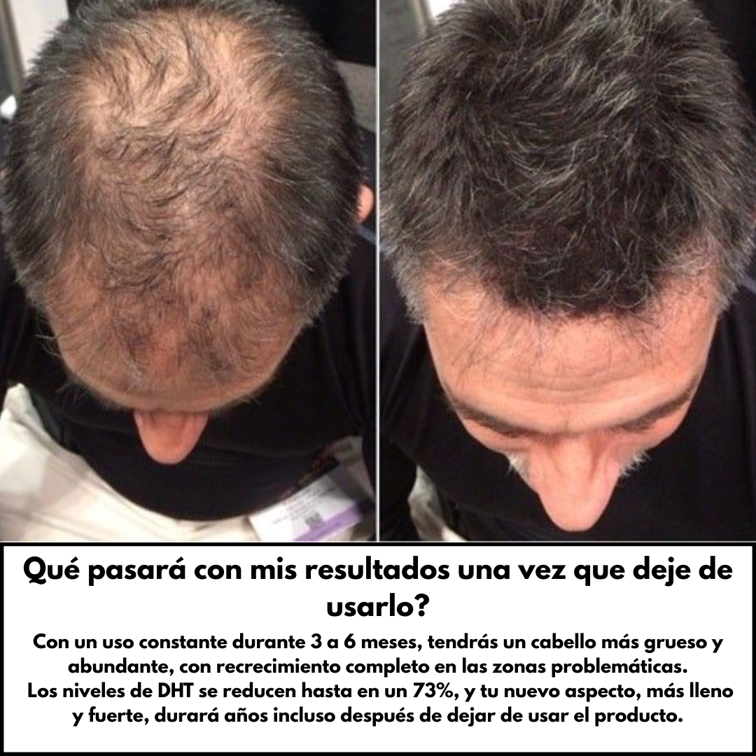 Sistema de Regeneración Capilar